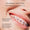 Close-up of a mouth with braces and text about a braces care product.